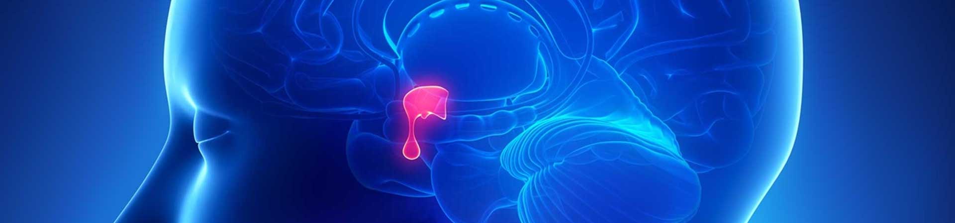Pituitary Tumor Treatment