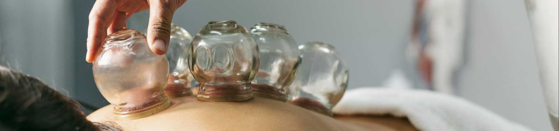 Cupping Therapy (Hijama) 